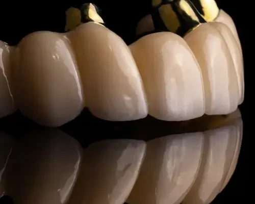 Orthopedic dental treatment in Odessa