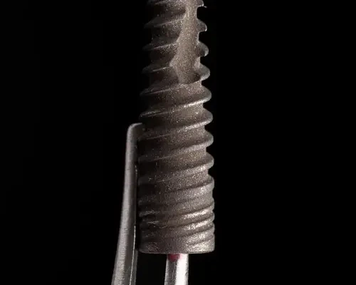 Full dental implantation in Odessa